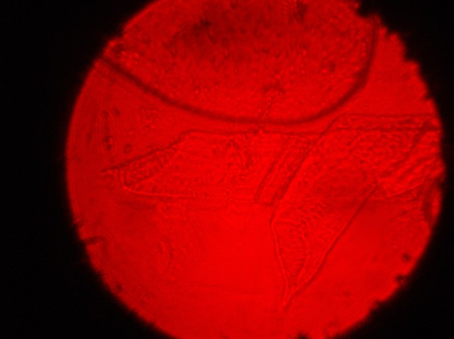 sluz na pljuih (2005 moj mikroskop)slino z antrax